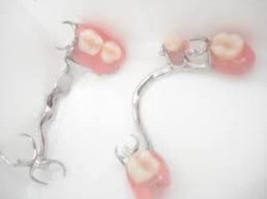 Prótese Dentária Removível